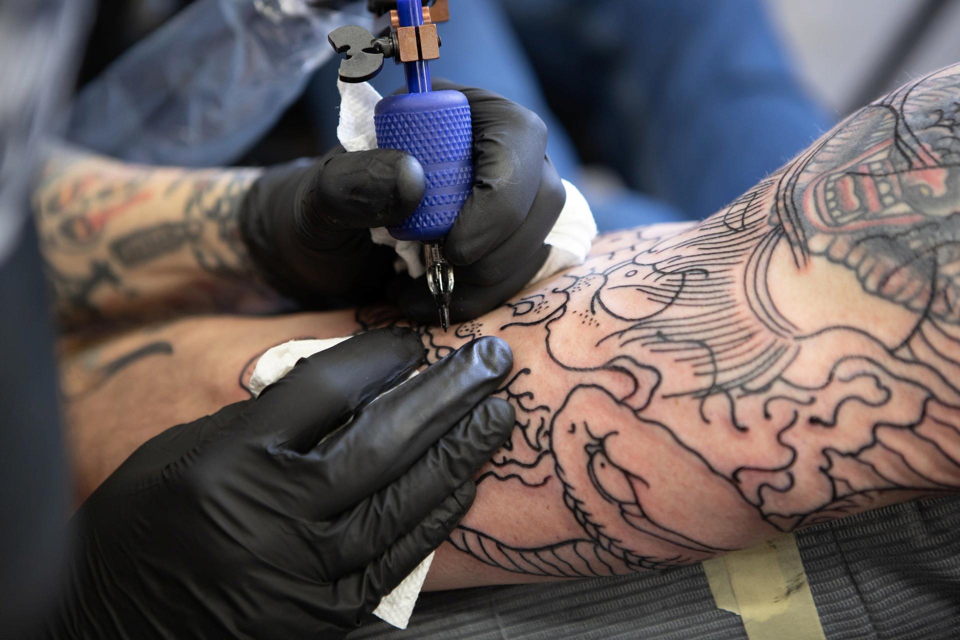 Things To Consider Before Removing A Tattoo